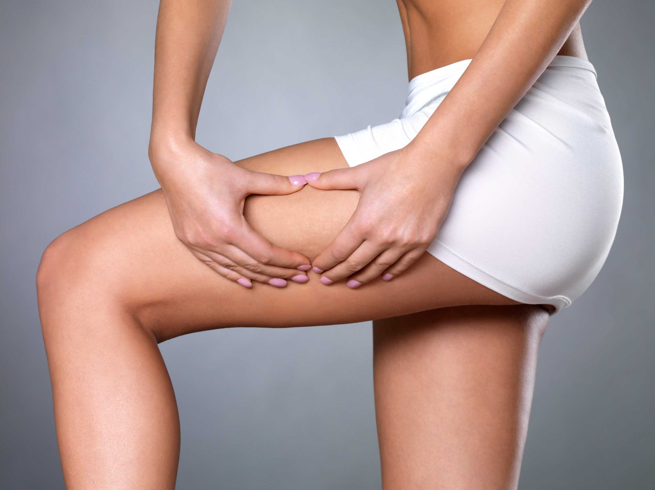 female squeezes cellulite skin her legs close up shot white space scaled